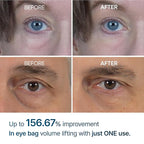 Dr Melaxin - Eyephalt Eyecream