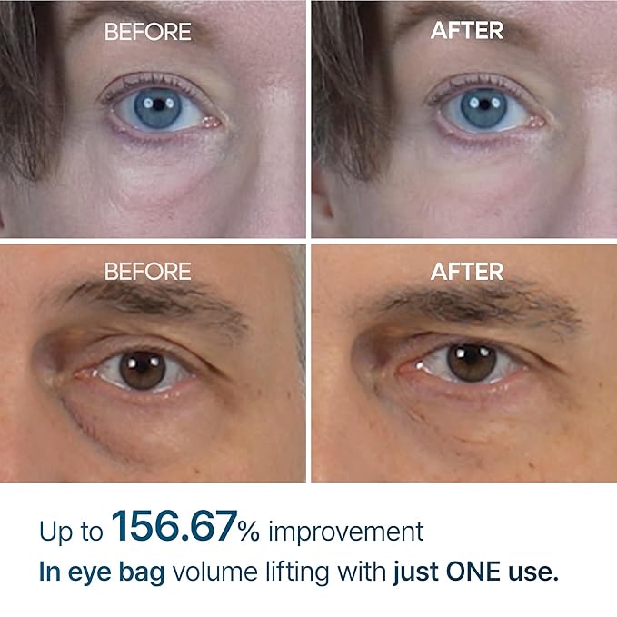 Dr Melaxin - Eyephalt Eyecream