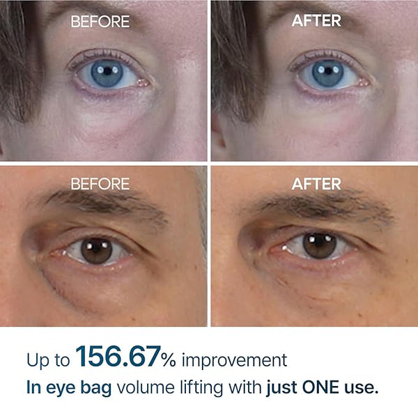 Dr Melaxin - Eyephalt Eyecream